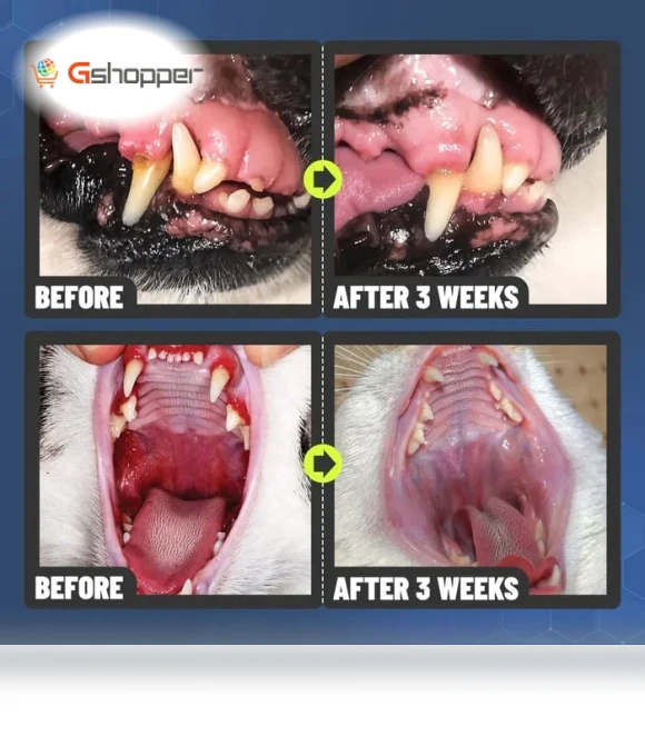 Teeth Cleaning Spray — Dental Care