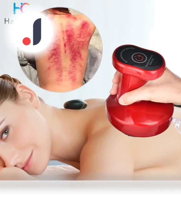 Electric Vacuum Cupping Massage Device — Massage Equipment, Cozy Cottage-Relax