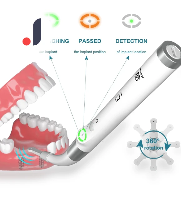 Dental Implant Detection System — Tools & Accessories, AI DENTAL
