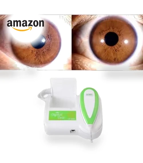 Iris Analyzer Camera — Pregnancy Health Monitors, QiQiBaby