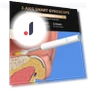 Smart Visual Ear Cleaner — Syringes, AE Selection