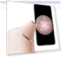 AI Visual Blackhead Remover Camera — Blackhead & Blemish Removers