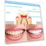Wire Control Tooth Set Accessories — Orthodontic Care Essentials