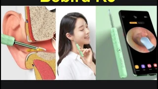 Xiaomi Bebird R3 Эндоскоп