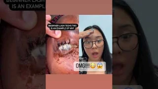 EYE INFECTION FROM LASH EXTENSIONS?!?