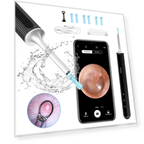 Smart Visual Ear Cleaner with HD Camera and WiFi — Blackhead & Blemish Removers, SUNUO