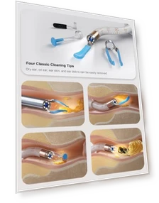 Earsight Plus Ear Wax Removal Tool Camera — Wax Removal, BEBIRD