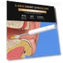 Smart Visual Ear Cleaner — Syringes, AE Selection